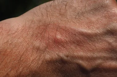 Ονειροκρίτης πρήξιμο