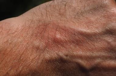 Ονειροκρίτης πρήξιμο