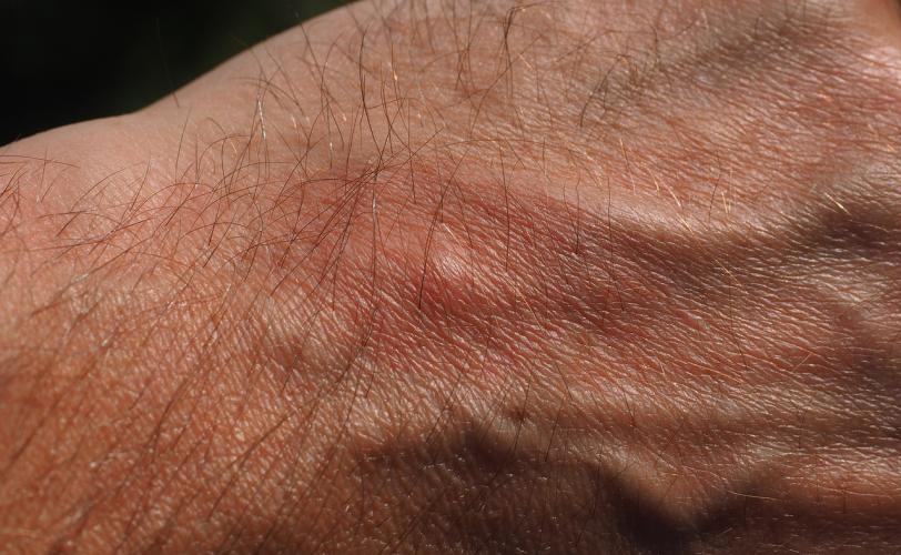 Ονειροκρίτης πρήξιμο