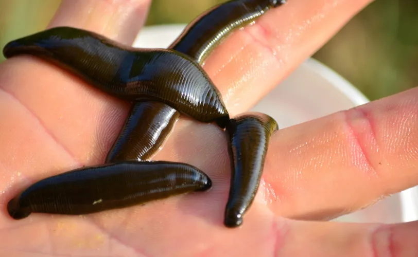 Ονειροκρίτης βδέλλα